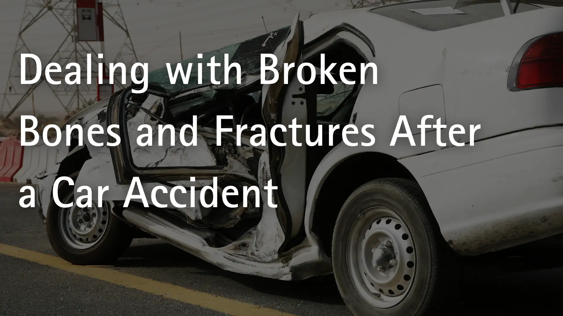 Dealing with Broken Bones and Fractures After a Car Accident Image